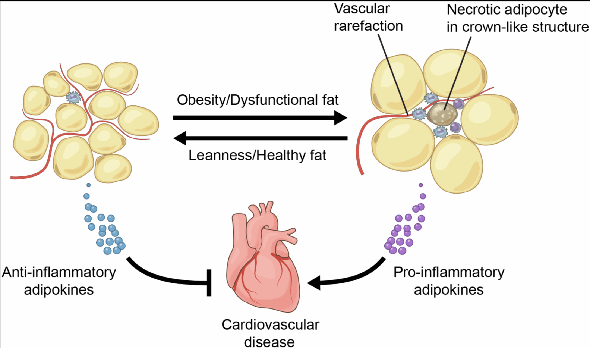 慢性炎症的来源